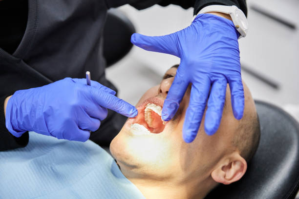Best Knocked-Out Tooth Emergency  in Osceola, MO